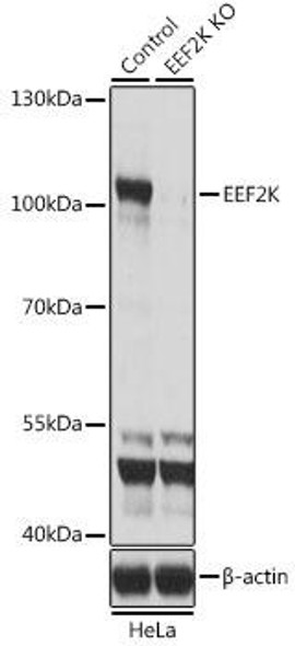 Anti-EEF2K Antibody (CAB5404)[KO Validated]