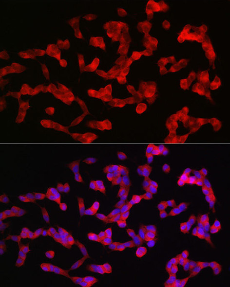 Anti-ANK3 Antibody (CAB20299)