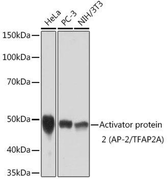 Anti-Activator protein 2 (AP-2/TFAP2A) Antibody (CAB2294)