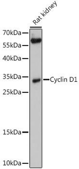 Anti-Cyclin D1 Antibody (CAB0310)