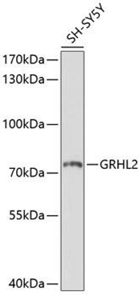 Anti-GRHL2 Antibody (CAB10153)