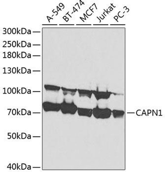 Anti-CAPN1 Antibody (CAB1172)