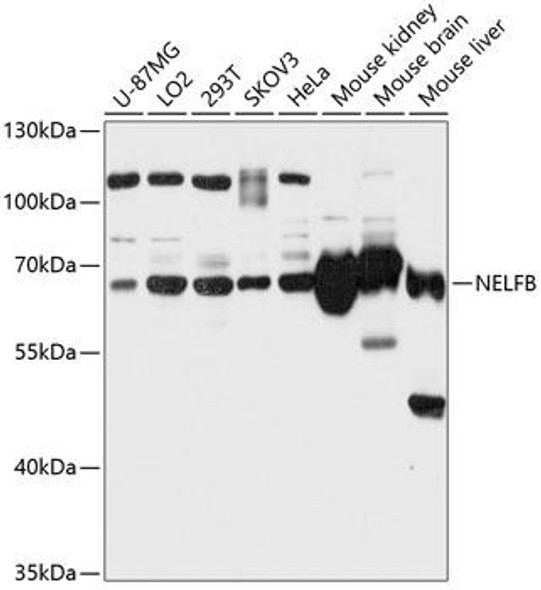 Anti-NELFB Antibody (CAB12023)