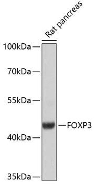 Anti-FOXP3 Antibody (CAB12051)