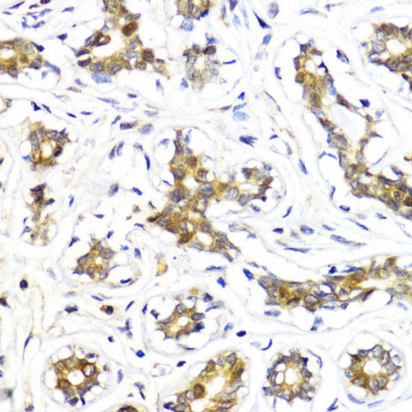 Anti-Akt2 Antibody (CAB1250)