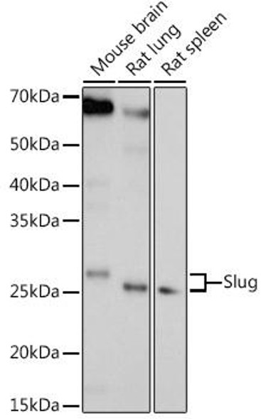 Anti-Slug Antibody (CAB13352)