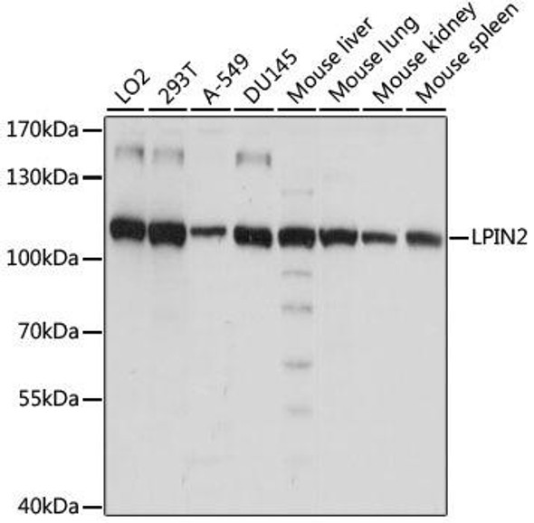 Anti-LPIN2 Antibody (CAB15762)