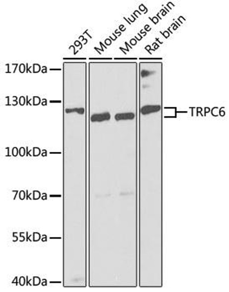 Anti-TRPC6 Antibody (CAB8155)
