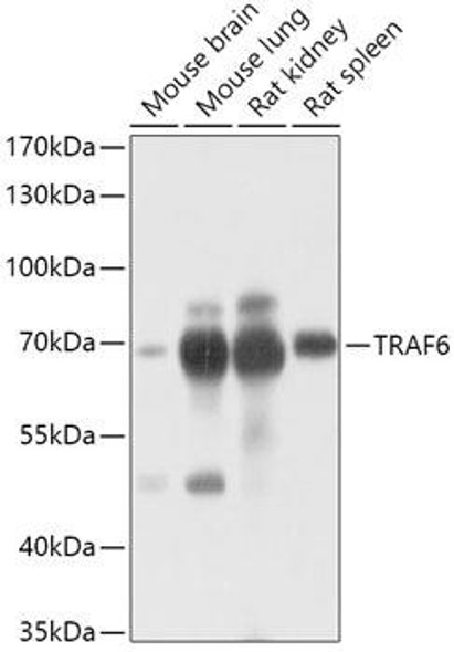 Anti-TRAF6 Antibody (CAB16991)