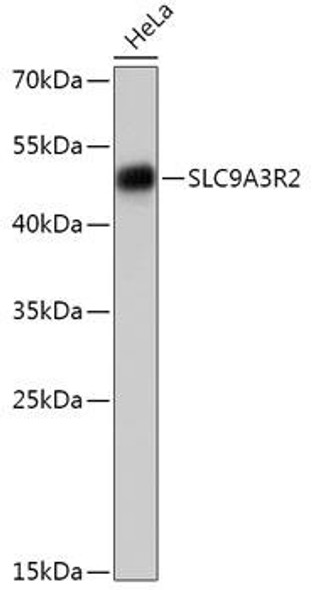 Anti-SLC9A3R2 Antibody (CAB17591)