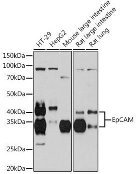 Anti-EpCAM Antibody (CAB19301)