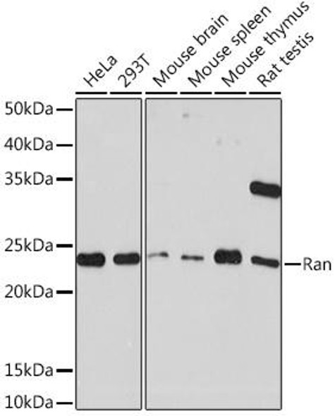 Anti-Ran Antibody (CAB4374)