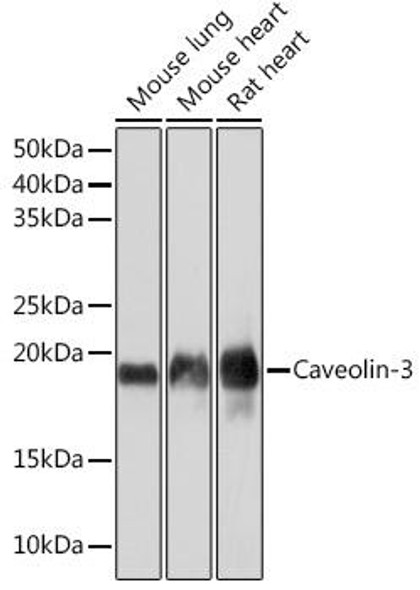 Anti-Caveolin-3 Antibody (CAB4891)