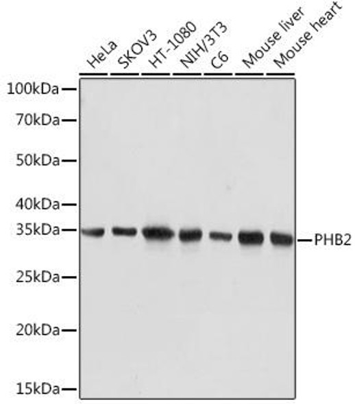 Anti-PHB2 Antibody (CAB9144)