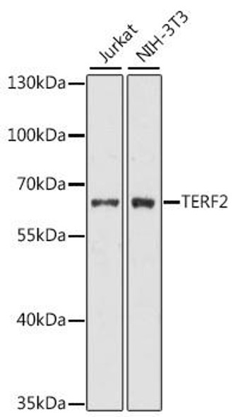 Anti-TERF2 Antibody (CAB0138)