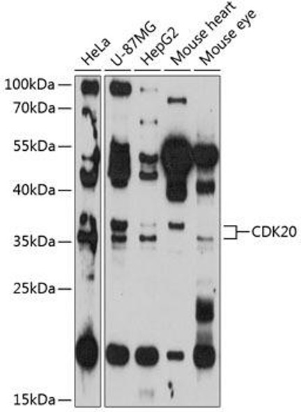 Anti-CDK20 Antibody (CAB11599)