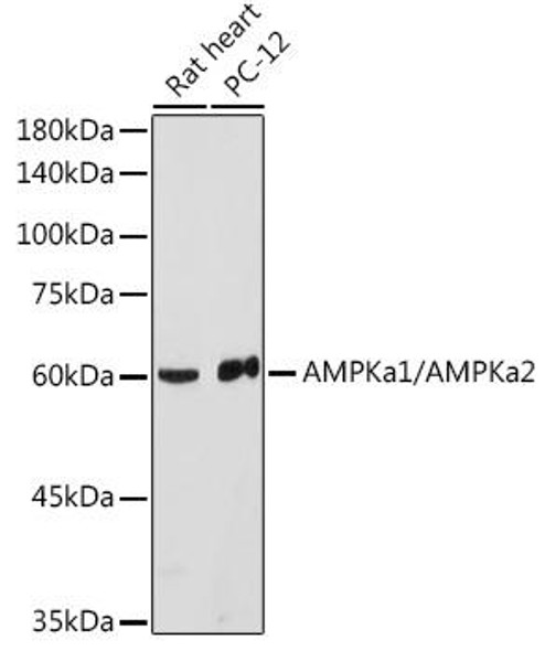Anti-AMPKa1/AMPKa2 Antibody (CAB12718)