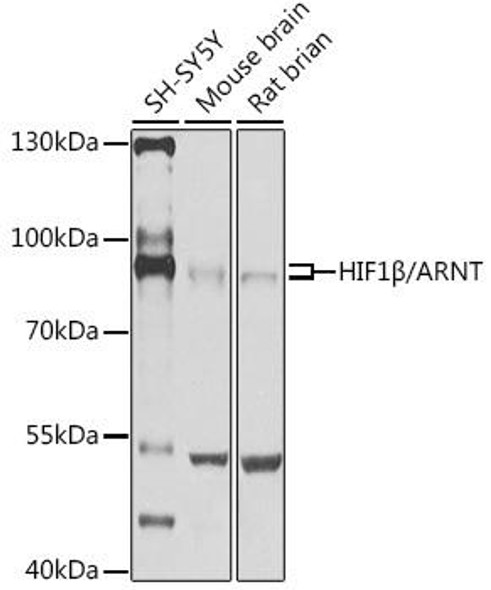Anti-HIF1Beta/ARNT Antibody (CAB14705)