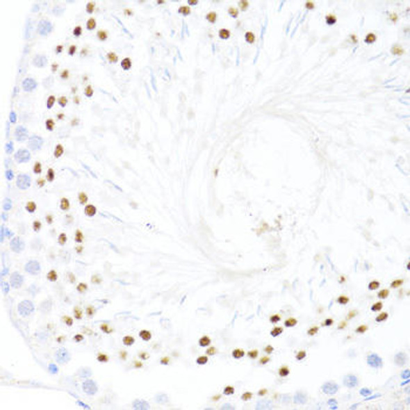 Anti-DDX59 Antibody (CAB14940)