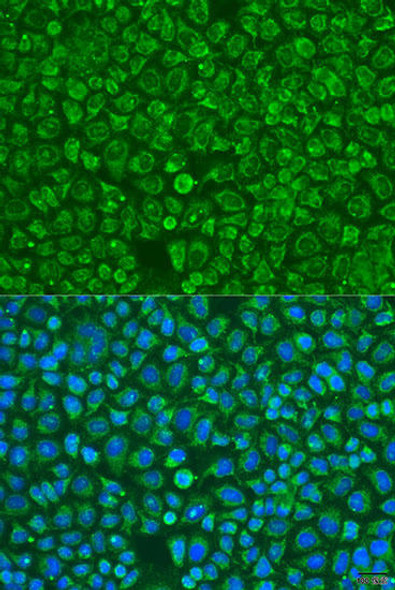 Anti-ARSF Antibody (CAB15031)