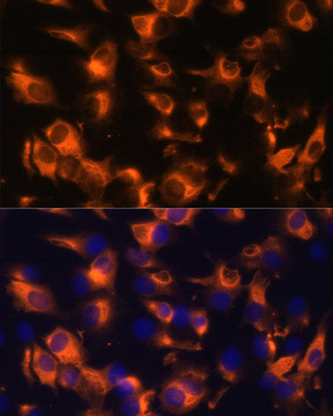 Anti-SSTR2 Antibody (CAB15101)