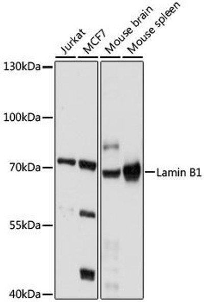 Anti-LMNB1 Antibody (CAB16685)