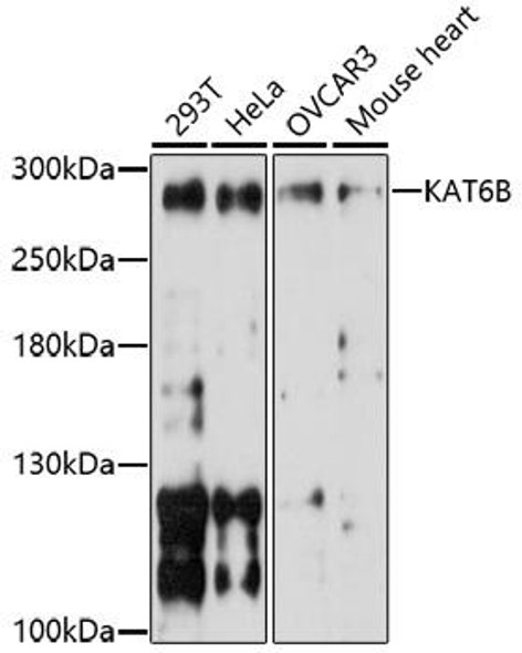 Anti-KAT6B Antibody (CAB17116)