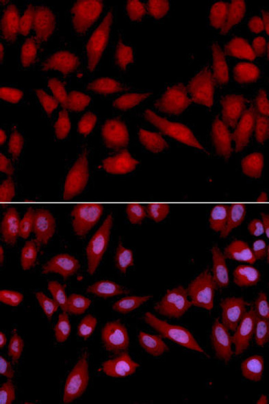 Anti-PSMA2 Antibody (CAB2504)