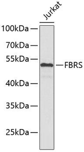 Anti-FBRS Antibody (CAB4927)