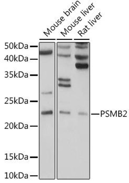 Anti-PSMB2 Antibody (CAB5483)