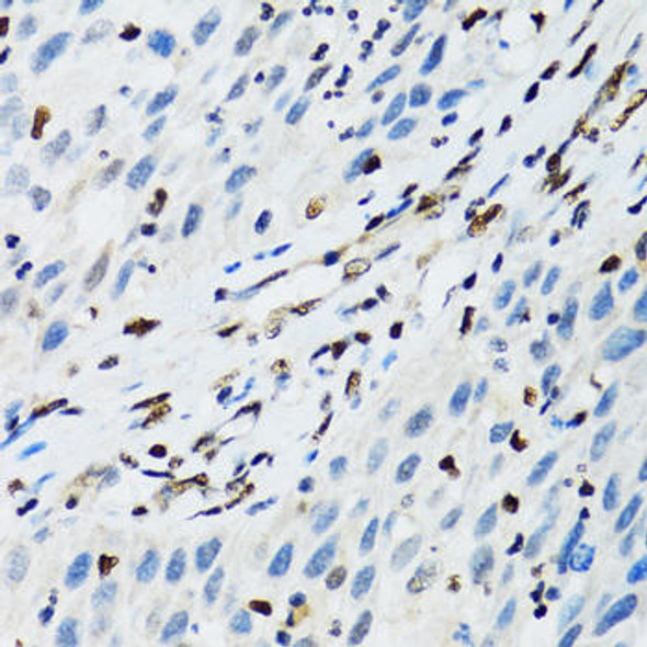 Anti-FLI1 Antibody (CAB5644)