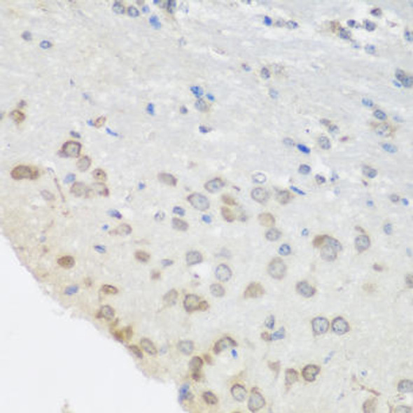 Anti-PUM1 Antibody (CAB6108)