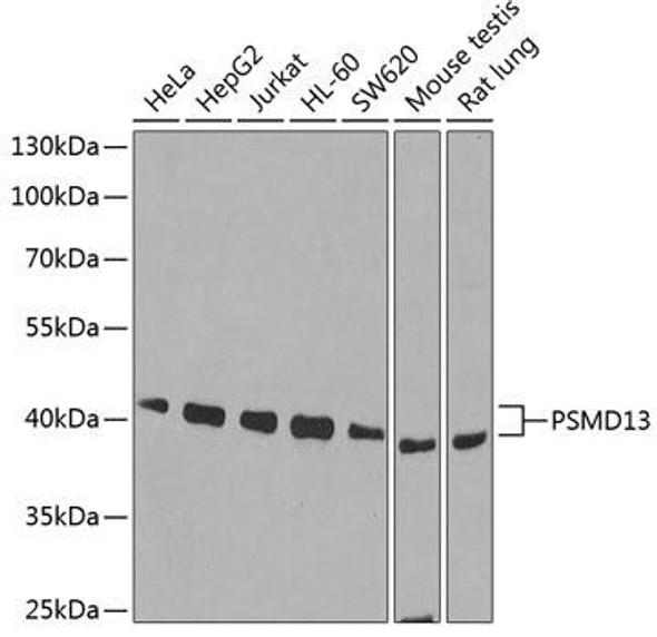 Anti-PSMD13 Antibody (CAB6956)