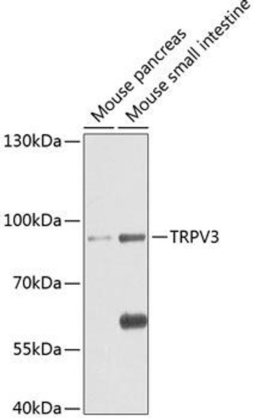 Anti-TRPV3 Antibody (CAB8598)