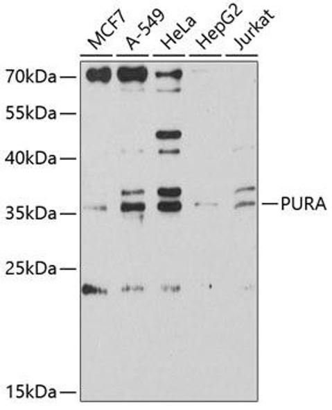 Anti-PURA Antibody (CAB9296)