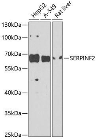 Anti-Alpha-2-antiplasmin Antibody (CAB9945)