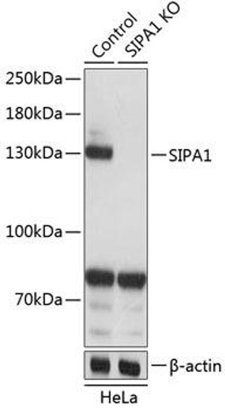 Anti-SIPA1 Antibody (CAB19867)[KO Validated]