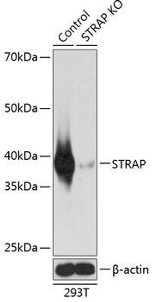 Anti-STRAP Antibody (CAB19989)[KO Validated]