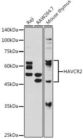 Anti-HAVCR2 Antibody (CAB20495)