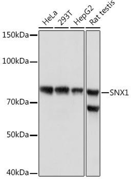 Anti-SNX1 Antibody (CAB3398)