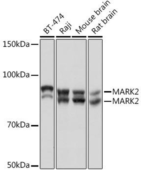 Anti-MARK2 Antibody (CAB6512)
