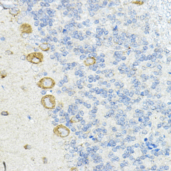 Anti-LRRC59 Antibody (CAB10022)