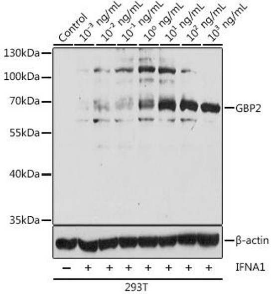 Anti-GBP2 Antibody (CAB12994)