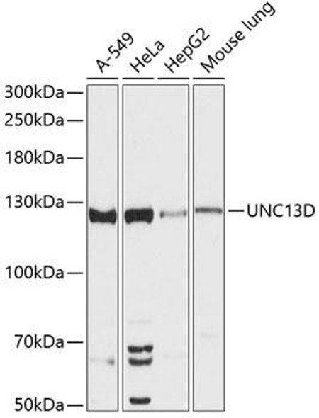Anti-UNC13D Antibody (CAB13141)
