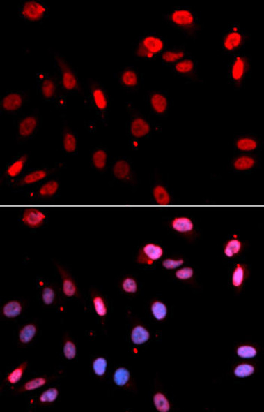 Anti-Rad18 Antibody (CAB13434)