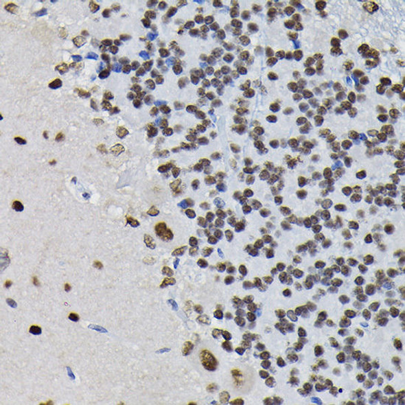 Anti-PPP1CB Antibody (CAB13528)