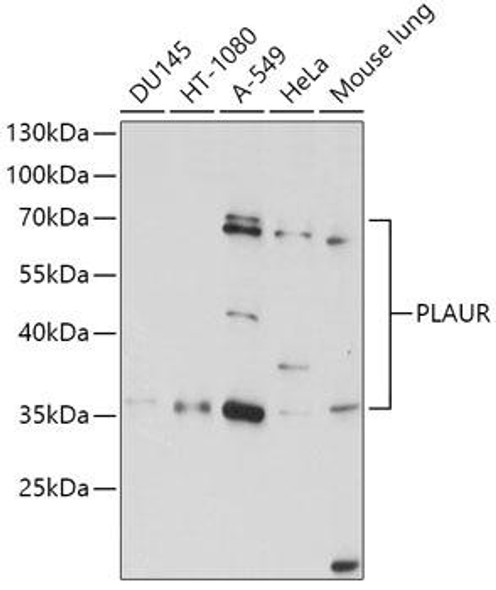 Anti-PLAUR Antibody (CAB1397)