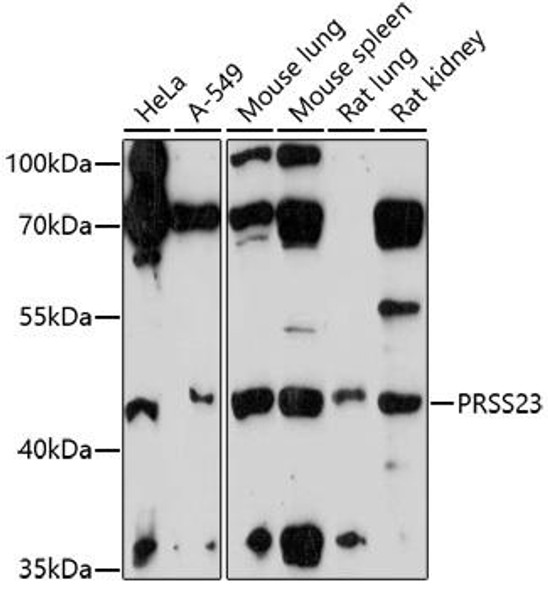 Anti-PRSS23 Antibody (CAB17092)