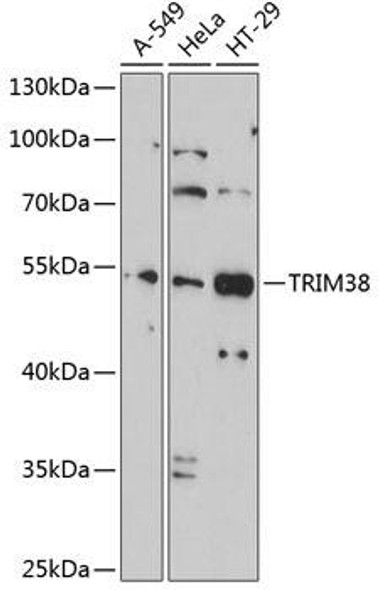 Anti-TRIM38 Antibody (CAB2600)