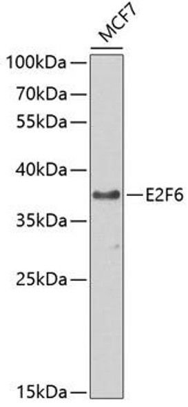 Anti-E2F6 Antibody (CAB2718)
